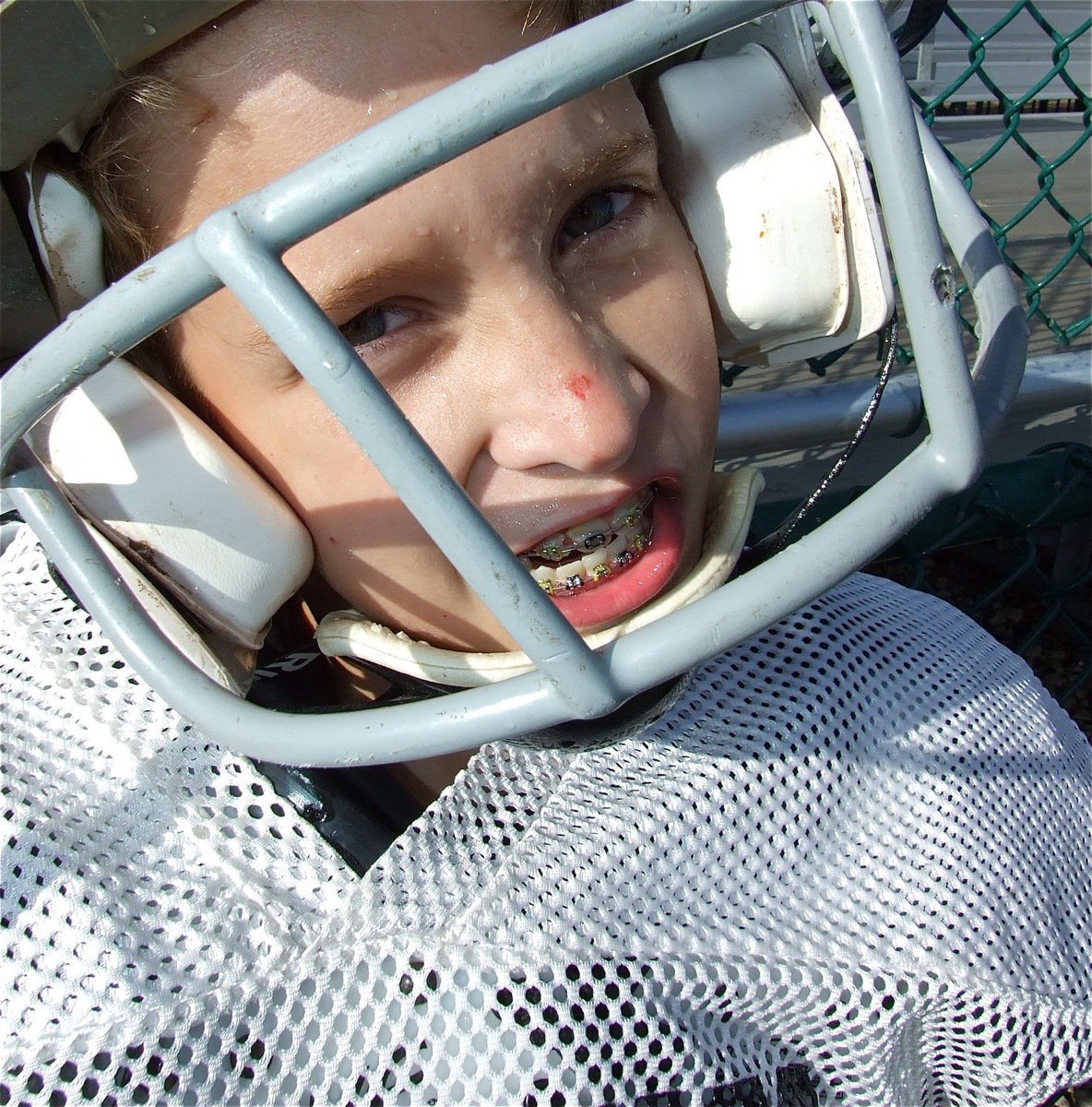 Image: Bring ’em on! — Carl Jaynes shows his blood, sweat and braces against the Mustangs.