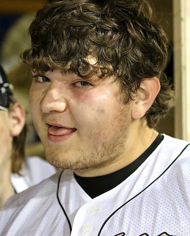 Image: Kevin Roldan(16) shows off his shiner before exiting the game and going to the E.R. in Waxahachie.